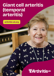 Giant Cell Arteritis (GCA)
