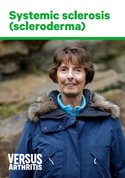 Systemic sclerosis (scleroderma)